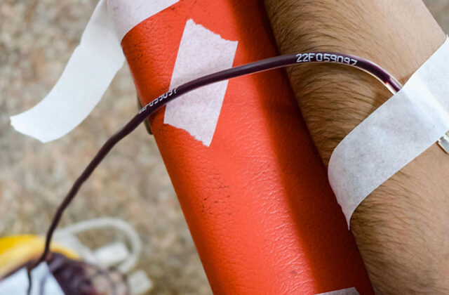 Close view of a donor's arm as they give blood plasma at a clinic.